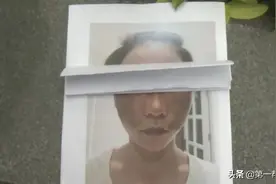 去美容店做祛斑，脸颊流脓留疤，商家却一问三不知图片