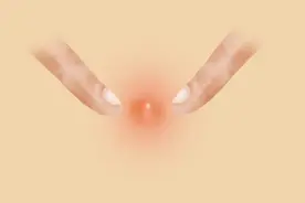 挤痘痘时，挤出的白色条状物、黄色颗粒以及脓液，是什么？图片