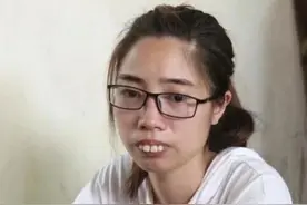 30岁女子太丑无人追，参加整容节目被“改造”，回家父母认不出图片