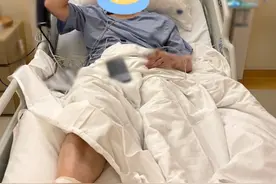 陈赫手术出院大口吃蟹，脸上痘痘太抢镜，半月前还脚缠绷带躺病床图片