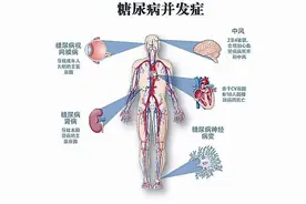 谈谈心内科大夫最害怕的疾病——糖尿病图片