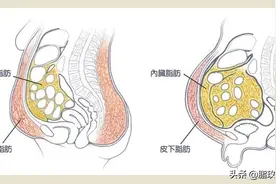 3种方法甩掉3类大肚子，每减一寸肚腩，可能不止年轻3岁图片