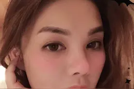 34岁名媛抽脂隆胸，因医生失误命丧手术台，丈夫怒控其涉嫌误杀图片