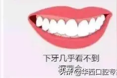 牙齿深覆合需要怎么矫正图片
