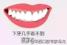 牙齿深覆合需要怎么矫正图片