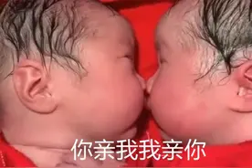 龙凤胎兄妹出生后一直“亲吻”，护士都没法分开，网友：很暖心图片