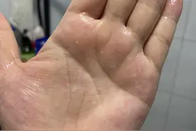 白吸盘吸出脏东西，神奇的毛孔“吸尘器”，洗后皮肤像鸡蛋般光滑图片