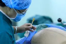 媳妇儿剖腹产，婆婆坚持让她卧床，医生喊话：想不想恢复的好？图片
