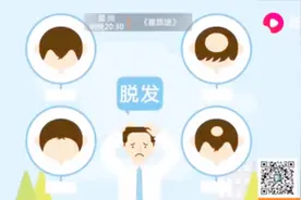 84%的30岁男性已开始脱发，专家：一把抓出5根头发及以上就是脱发视频封面