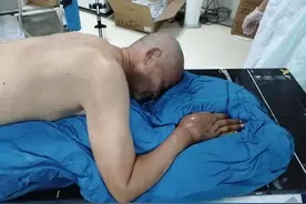 爹爹手上长了个大包块，疼的难以忍受图片