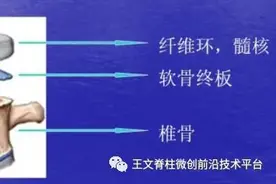 终板炎---一种经常被忽视的疼痛原因图片
