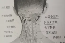 眩晕九个月，视物不清，颈椎病如此难治吗？三针轻松图片