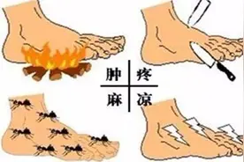 预防糖尿病足 这些检查在家就能做图片