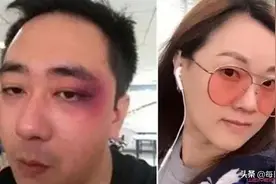 著名主持人被老婆家暴，暴打500多次耳光烟头烫伤6次，终于离婚图片