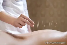有事没事扎针灸？老中医告诉你：针灸前后有讲究图片