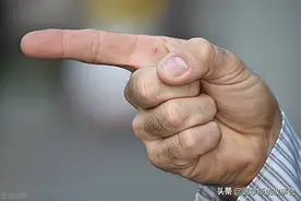 体内有癌，手指先知？手指若有这三个特征，真的提示癌症到访吗？图片