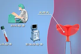 啪后腹痛恐是盆腔炎？盆腔炎如何确诊？治疗期间注意啥？动漫解读图片