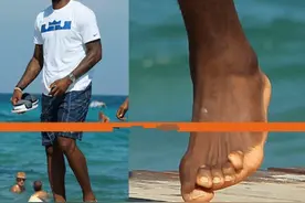 NBA球员赚上千万很容易？看这些照片就明白，詹姆斯脚趾变形图片