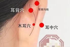 中医健康养生之人体耳部穴位耳三穴图片