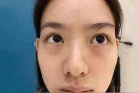 孙一宁整容素颜照疑曝光，被曝整了两个地方，怼脸拍显露真实颜值图片