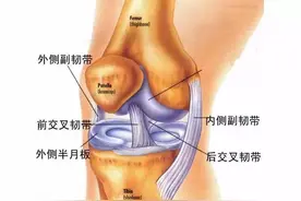 前交叉韧带损伤该怎么办？图片