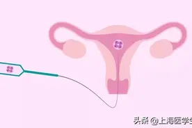 试管婴儿冻胚VS鲜胚！如何移植更有利于怀孕？图片