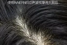 洗头重在洗头皮！头皮“吸尘器”更专业，连毛囊都能给你洗干净图片