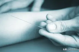 初学者学习针灸，记住师父扎的每一个穴位，为什么还是没有疗效？图片