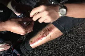 痛也不放手，我不能让嫌疑人逃走！图片