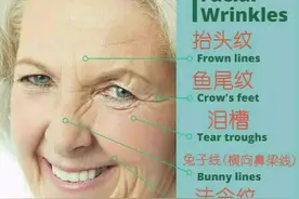 鱼尾纹能夹苍蝇了，以为自己是美人鱼吗？在家地位=捕蝇器了吧？图片