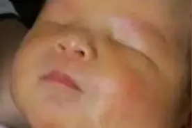 婴儿被检查“天生无眼睛”，医生的话让妈妈瘫倒在地图片