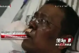 噩耗传来！那个面容“变黑”的医生，还是走了图片