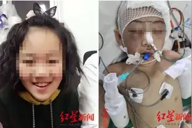 把12岁继女打成植物人！继母一审被判无期，父亲：她庭审中非常坦然，没一点惭愧的样子图片