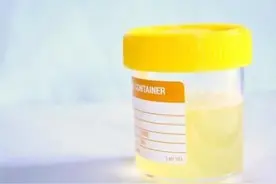 小便次数越多，暗示身体健康越差吗？看看事实真相是什么图片