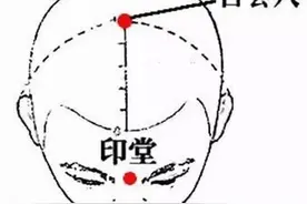 神奇的百会穴图片