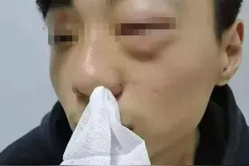 开封一中专生遭老师殴打吐血续：校方称打人者为临时工 已辞退图片