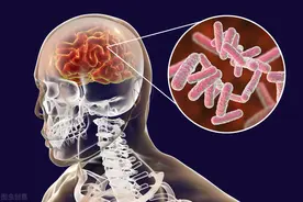 什么叫脑供血不足？头晕一定是脑供血不足吗？请查看全文图片
