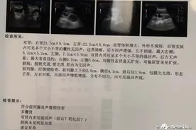 一个新药的仿制，给肝硬化、心衰、多囊肾患者带来福音图片