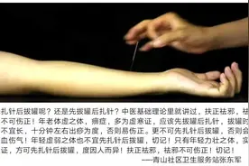 先扎针后拔罐呢？还是先拔罐后扎针？图片
