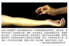 先扎针后拔罐呢？还是先拔罐后扎针？图片