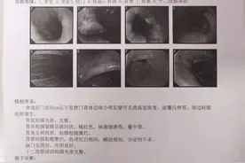 我院肝胆外科主任许其威、副主任医师兰军良团队完成一例保脾全胰十二指肠联合全胃根治性切除治疗多原发癌图片