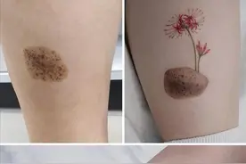 22个创意的疤痕纹身作品，简直太秀了图片