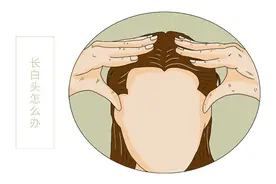 年纪轻轻为何就长白头发了？长白头发的人不容易得癌，是真的吗？图片
