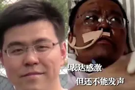 两名医生感染新冠肺炎，被救回后脸部完全变黑，原因找到了图片