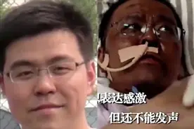 两名医生感染新冠肺炎，被救回后脸部完全变黑，原因找到了图片