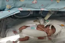 罕见！三个胎儿分3次"出生"，广州三胞胎妈妈艰难保胎、延迟分娩图片