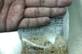 八旬老人患肾结石、输尿管结石 专家施行最先进的微创清石术图片