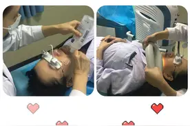 光子嫩肤——零距离体验图片