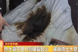 分分钟秒变"定时炸弹"，这种热水袋千万不要用了！图片