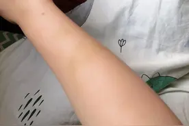 前两天被咬的牙印淤青了，这已经够狠了，没想到你连自己也不放过图片